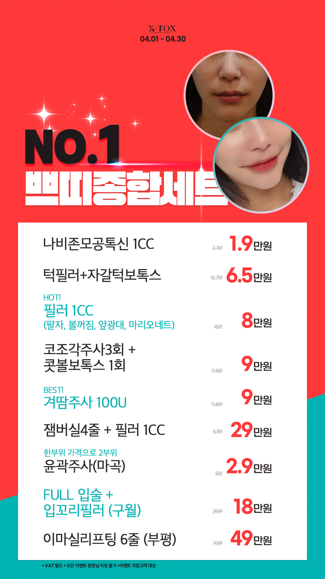 케이톡스의원 Brand > Event > 초특가 이벤트